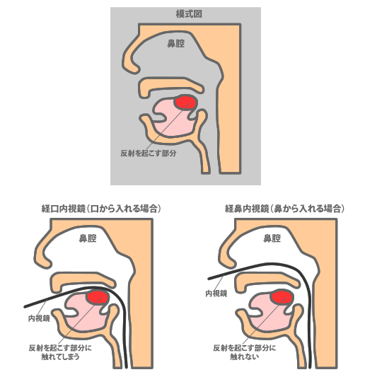 経鼻内視鏡